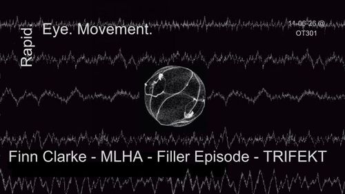 Rapid Eye Movement (R.E.M.)