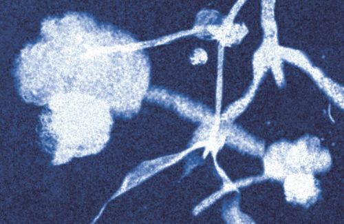 Hoe ga je om met een eetstoornis?