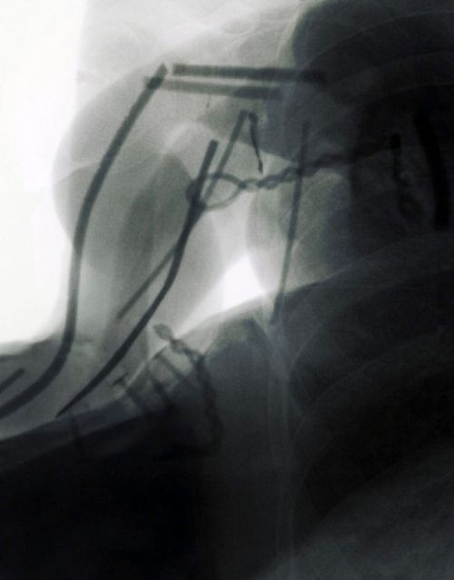 Transcorporeality in Toxic Times