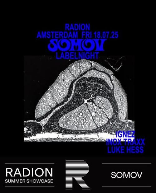 RADION SHOWCASE Somov